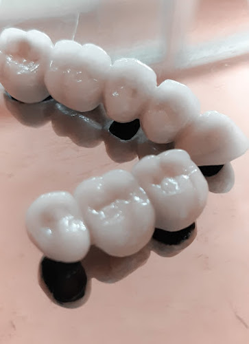 dentista barato Izúcar de Matamoros
