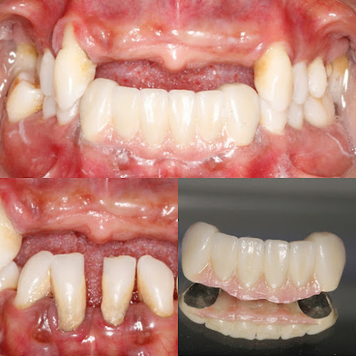 dentista barato Aguascalientes