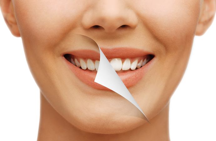 dentista barato Apodaca