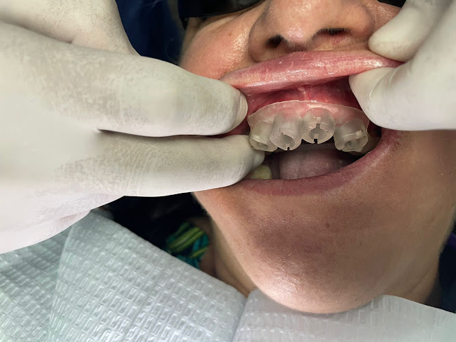 dentista barato Sonora