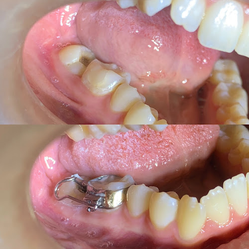 dentista barato Ciudad Altamirano (Pungarabato)