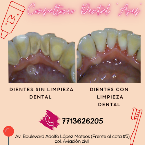 dentista barato Huejutla de Reyes