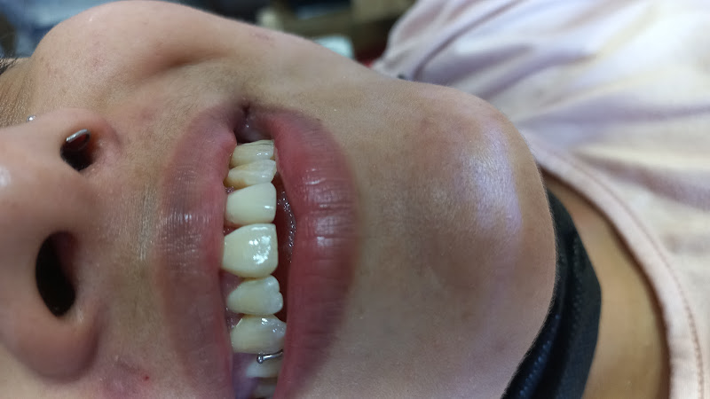 dentista barato Baja California Sur