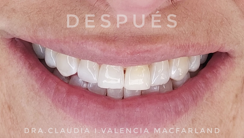 dentista barato Ensenada