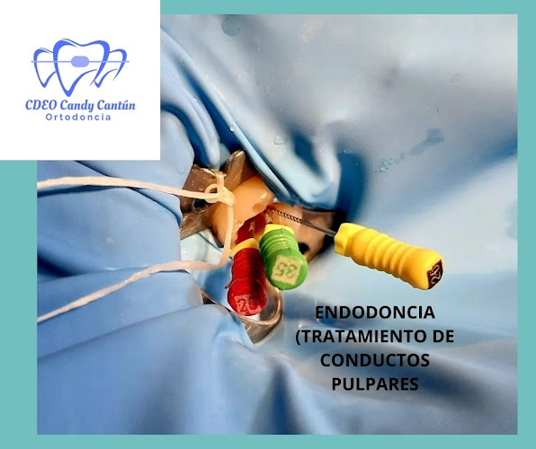 dentista barato Valladolid