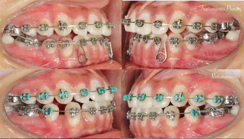dentista barato Cuauhtémoc