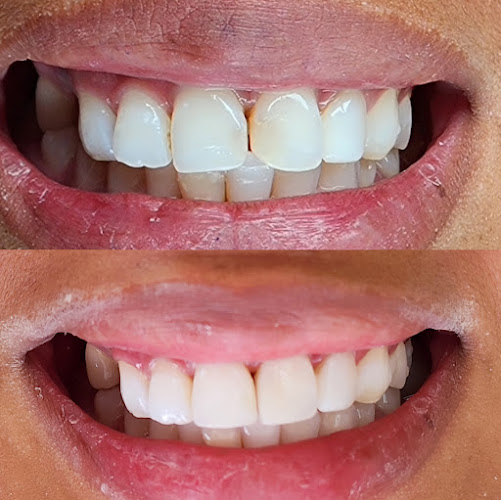 dentista barato Ensenada