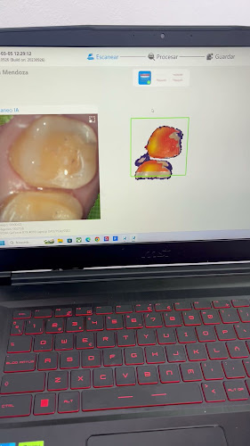 dentista barato Metepec