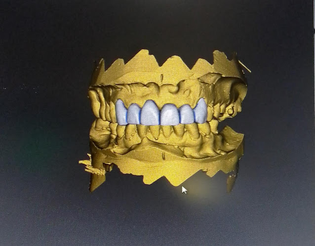dentista barato Cuauhtémoc