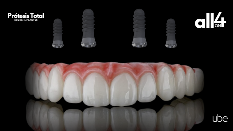 dentista barato Metepec