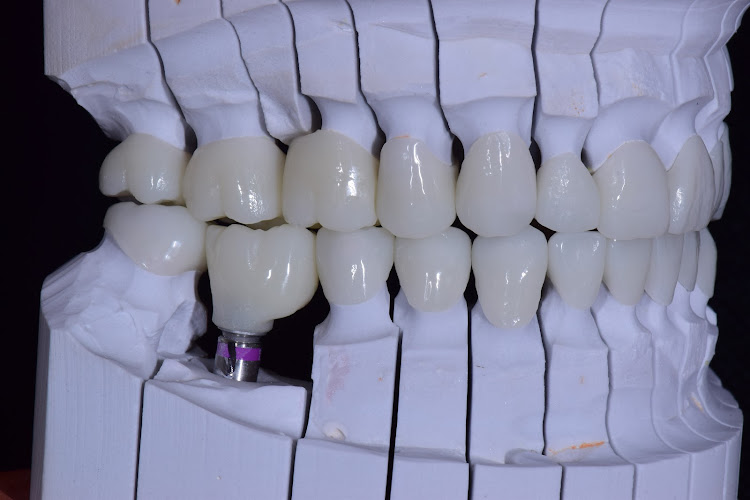 dentista barato San Luis Potosí