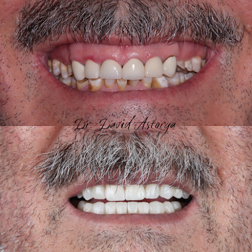 dentista barato Camargo