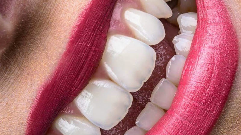 dentista barato Guanajuato