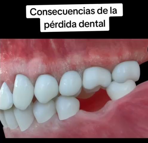 dentista barato Hidalgo