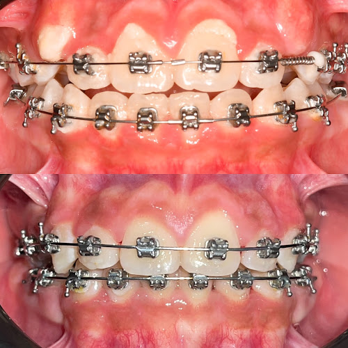 dentista barato Tabasco