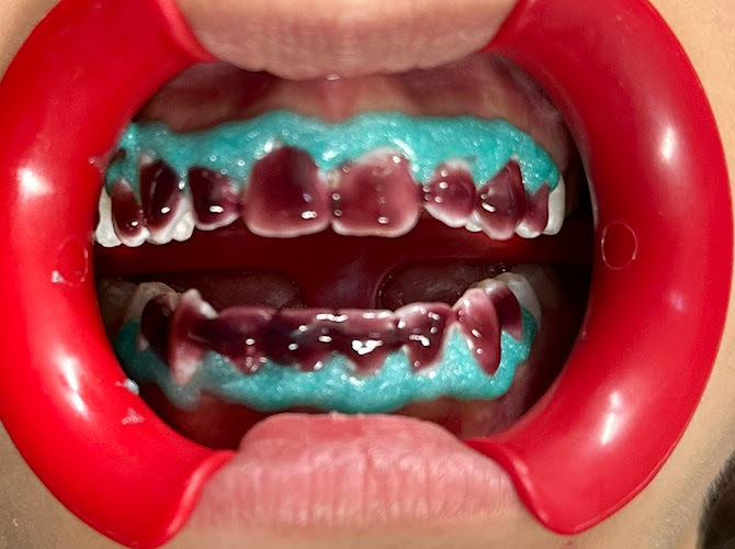 dentista barato Pabellón de Arteaga