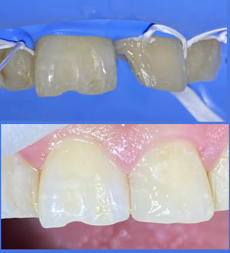 dentista barato Cuajimalpa de Morelos