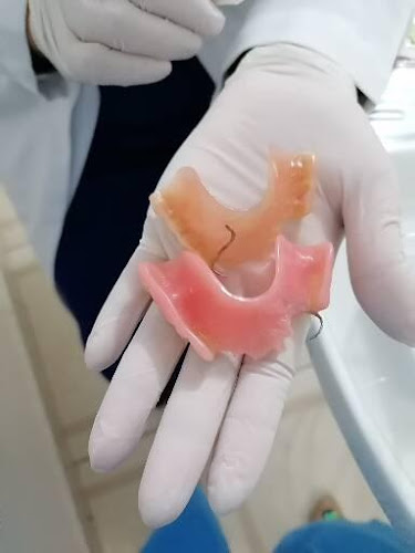 dentista barato San Andrés Tuxtla