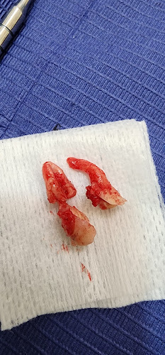 dentista barato San Andrés Tuxtla