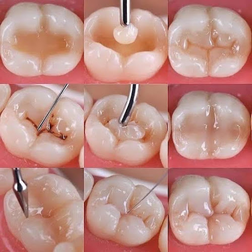 dentista barato Ciudad Altamirano (Pungarabato)