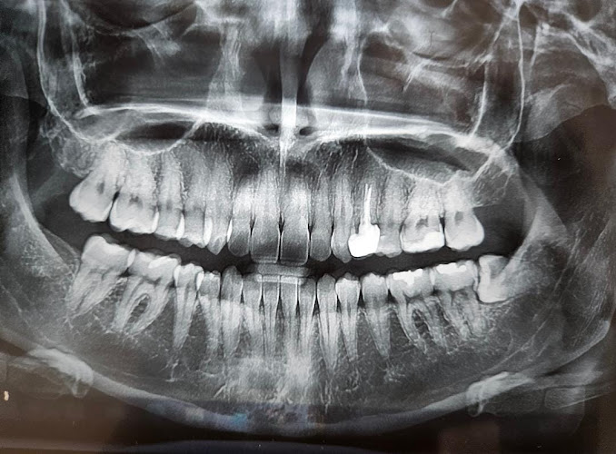 dentista barato Jalisco