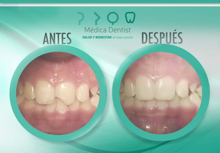 dentista barato Tlalnepantla de Baz
