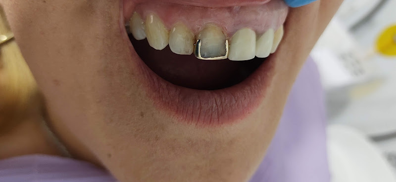 dentista barato Vicente Guerrero