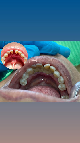 dentista barato Baja California